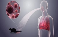 Bộ Y tế cảnh báo khẩn sau vụ 3 người tử vong do virus Hanta trên tàu du lịch