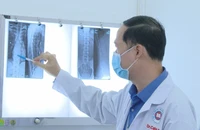 Đi nắn bẻ khớp tại một thầy lang, bệnh nhân bị gãy xương sườn