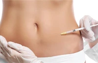 Tiêm tan mỡ có giảm béo hiệu quả như lời đồn?