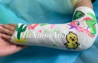 Biến nỗi đau bó bột thành tác phẩm nghệ thuật