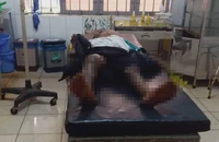 Xã Ea Sol thông tin vụ bé trai 8 tuổi ở Đắk Lắk bị đốt bỏng chân 