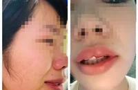 Vụ cô giáo bị phụ huynh đánh: Tỉnh Đắk Nông yêu cầu công an vào cuộc