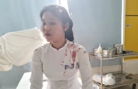 Nữ sinh ở Đắk Lắk bị bạn đánh khâu 4 mũi vẫn còn hoảng loạn
