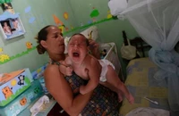 Virus Zika chính là thủ phạm gây teo não 