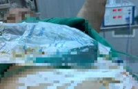 Hi hữu: Người đàn ông tự cắt dương vật vì đi tiểu khó