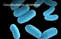 Các biến chứng nguy hiểm của bệnh bạch hầu, có thể gây tử vong