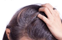 Tại sao càng nhuộm tóc bạc càng nhanh và nhiều?