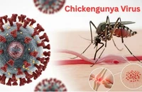 Vaccine sốt xuất huyết có ngừa được dịch bệnh Chikungunya?