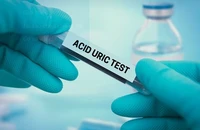 Nồng độ acid uric trong máu bao nhiêu là bình thường?