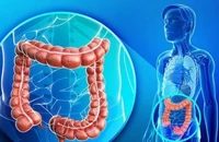 Hội chứng ruột kích thích có chữa khỏi được không?