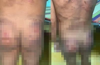 Khởi tố cha dượng và mẹ ruột hành hạ cháu bé 7 tuổi