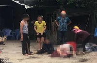 Tưới xăng tự thiêu vì mâu thuẫn gia đình