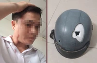 Công an triệu tập người dùng cây sắt đánh vỡ nón bảo hiểm người đi đường 
