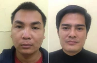 Vào bệnh viện chào bán thận với giá 1,1 tỉ đồng