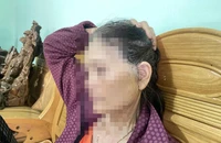 Phẫu thuật thẩm mỹ trái phép khiến 1 phụ nữ nhập viện cấp cứu 