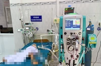  3 trẻ bị ong vò vẽ đốt phải nhập viện, 1 trẻ tử vong
