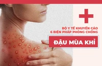 Bộ Y tế khuyến cáo 6 biện pháp phòng chống đậu mùa khỉ