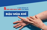 4 giai đoạn và 5 dấu hiệu nguy hiểm của bệnh đậu mùa khỉ