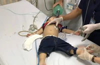 Cứu bé trai 22 tháng tuổi hóc thạch rau câu ngưng thở, ngưng tim 