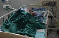 Đi lấy nhộng, 1 đàn ông ở Quảng Nam bị ong đốt nguy kịch
