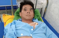 Một chú chó Becgie ở Đắk Lắk lao vào cắn chủ bị thương nặng