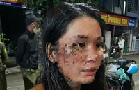 Nữ nhân viên giao hàng tố bị đánh bầm dập vì… chiếc áo bị chật