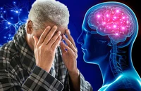 Hay quên có phải bị sa sút trí tuệ?