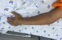 Ra sau nhà bếp đánh răng, bé trai 8 tuổi bị rắn lục cắn nguy kịch