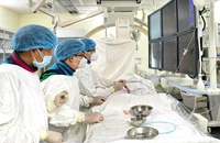 Bị đột quỵ nguy kịch vì thói quen giác hơi trị đau lưng