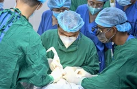 Bị lồi mắt, đi khám phát hiện u hốc mắt, nguy cơ ảnh hưởng não