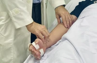 TP.HCM ghi nhận 1 ca tử vong do sốt xuất huyết