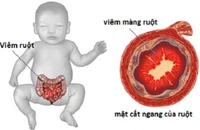 (Ảnh minh họa)