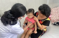 Ca tay chân miệng tăng, khó nhận biết khi gặp thể không điển hình