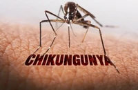 TP.HCM duy trì giám sát, chủ động ứng phó dịch bệnh Chikungunya 