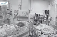 2 chị em bị bỏng nặng nghi do cha ruột phóng hỏa