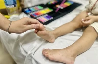 Chăm sóc trẻ mắc tay chân miệng tại nhà 