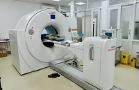 Những ai nên tầm soát ung thư phổi?