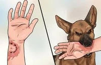 Xử trí đúng cách ngay sau phơi nhiễm để phòng ngừa bệnh dại