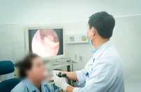 Suýt chết vì ngậm rất nhiều viên C sủi chữa hóc xương cá