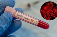 TP.HCM siết giám sát cửa khẩu, ngăn nguy cơ dịch Ebola xâm nhập cộng đồng