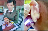 Kiên Giang: Khởi tố cô giáo bạo hành trẻ khi cho ăn