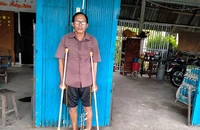 Tòa trả hồ sơ vụ đánh gãy chân người thợ hồ