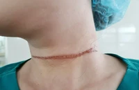 Cảnh báo tai nạn từ thả diều