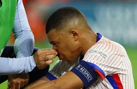 Mbappe rời sân với cái mũi đầy máu, đội tuyển Pháp thiệt hại nặng nề