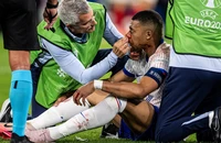 Sốc: Mbappe bị gãy mũi phải lên bàn mổ, nghỉ ít nhất 10 ngày hoặc mất Euro