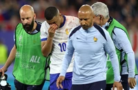 ‘Mbappe bị gãy mũi không phải là ngày tận thế’