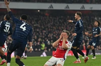 Bị sẩy chân đau đớn, HLV Mikel Arteta nói điều bất ngờ về Arsenal 