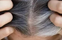 3 loại phụ liệu thực phẩm giúp ngăn ngừa tóc bạc sớm