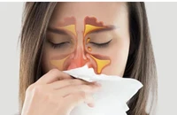 5 loại thực phẩm giúp giảm đau khi bị viêm xoang 