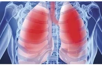 Lời khuyên cho người đang bỏ hút thuốc lá và cách tăng cường sức khỏe phổi
